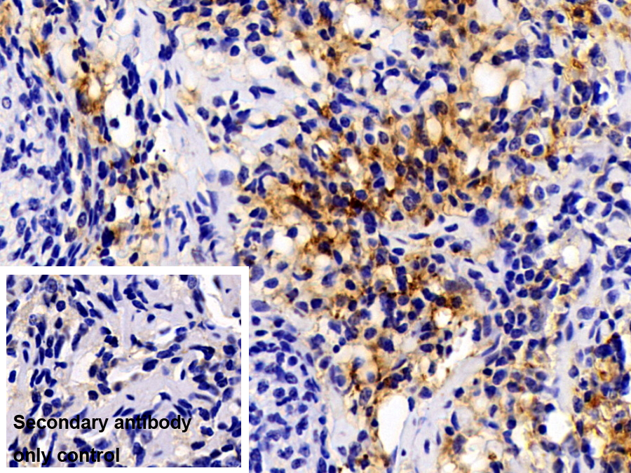 Polyclonal Antibody to Lysyl Oxidase Like Protein 1 (LOXL1)