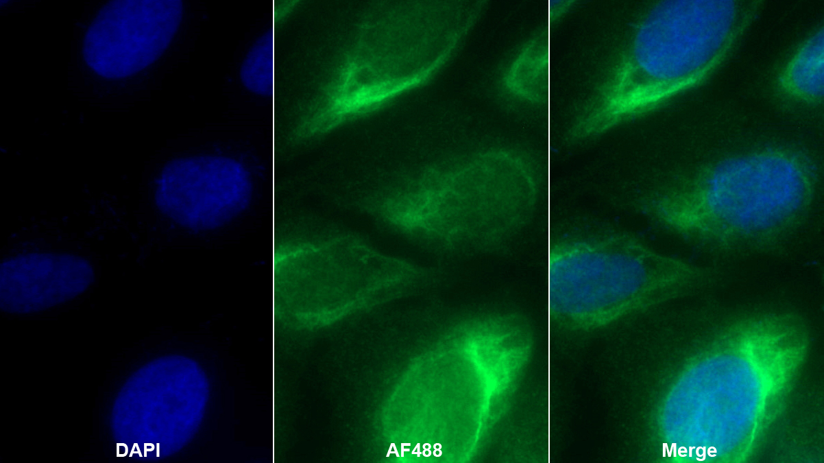 Polyclonal Antibody to Lysyl Oxidase Like Protein 4 (LOXL4)