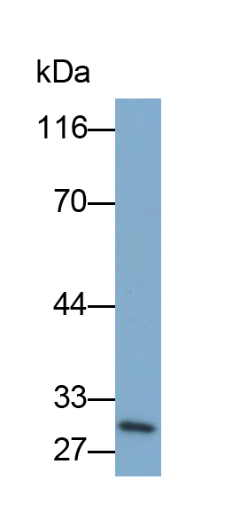 Polyclonal Antibody to Uncoupling Protein 1, Mitochondrial (UCP1)