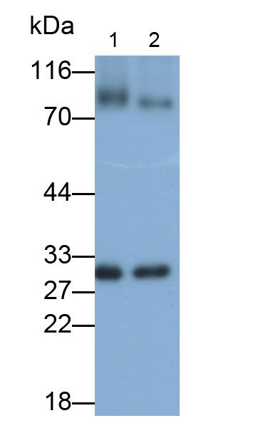 Polyclonal Antibody to Mitofusin 2 (MFN2)