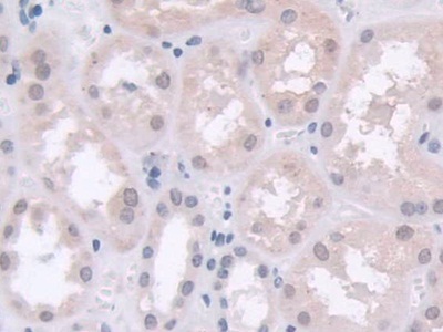 Polyclonal Antibody to Chordin Like Protein 1 (CHRDL1)