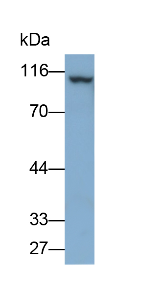 Polyclonal Antibody to Phosphodiesterase 5A, cGMP Specific (PDE5A)