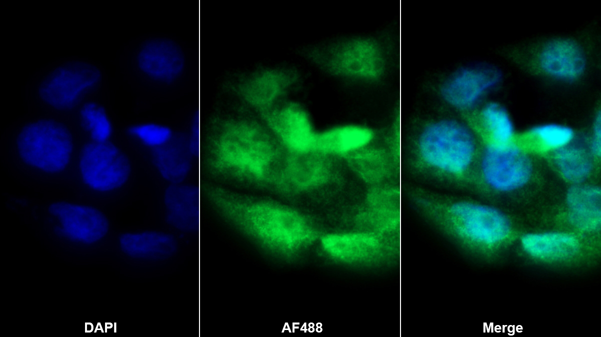 Polyclonal Antibody to Nuclear Transcription Factor Y Gamma (NFYC)