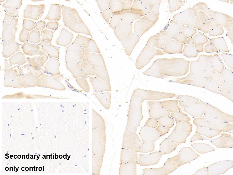 Polyclonal Antibody to Peptidyl Arginine Deiminase Type II (PADI2)