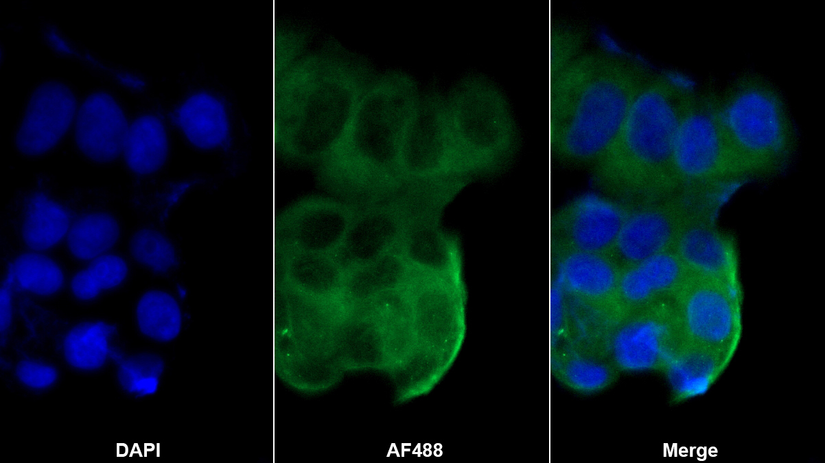 Polyclonal Antibody to Peptidyl Arginine Deiminase Type III (PADI3)
