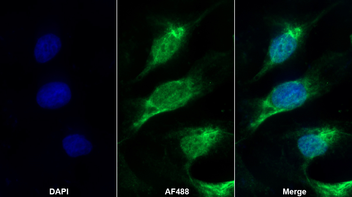 Polyclonal Antibody to Polycomb Group Ring Finger Protein 4 (PCGF4)