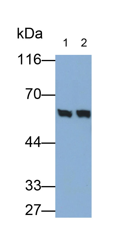 Polyclonal Antibody to Phosphoglucomutase 5 (PGM5)