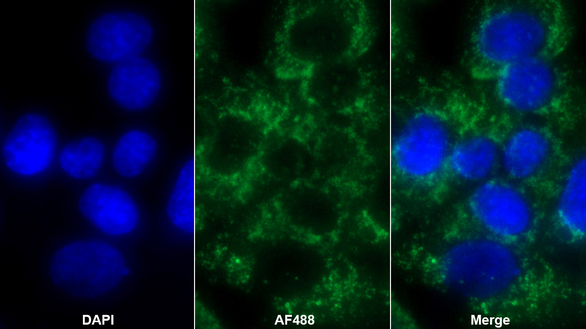 Polyclonal Antibody to Peroxiredoxin 3 (PRDX3)