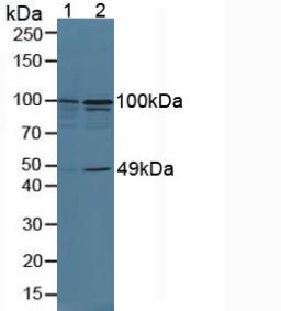 Polyclonal Antibody to Tumor Necrosis Factor Alpha Induced Protein 3 Interacting Protein 2 (TNIP2)