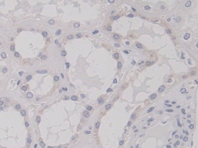 Polyclonal Antibody to Tensin 3 (TNS3)
