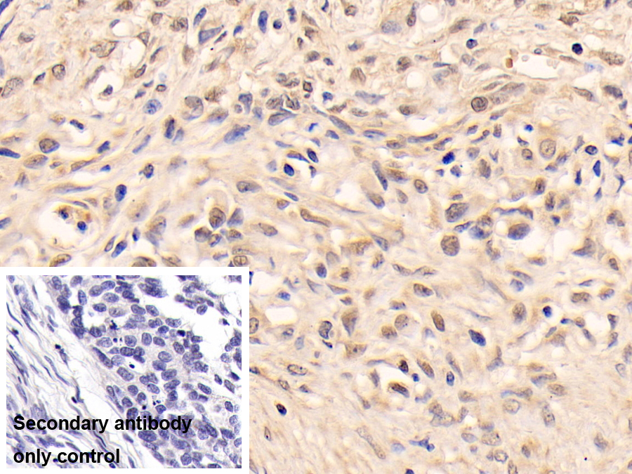 Polyclonal Antibody to Phosphatase And Tensin Homolog (PTEN)