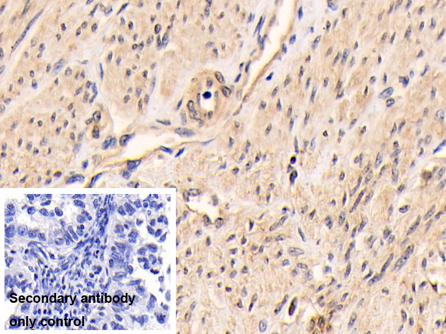 Polyclonal Antibody to Phosphatase And Tensin Homolog (PTEN)