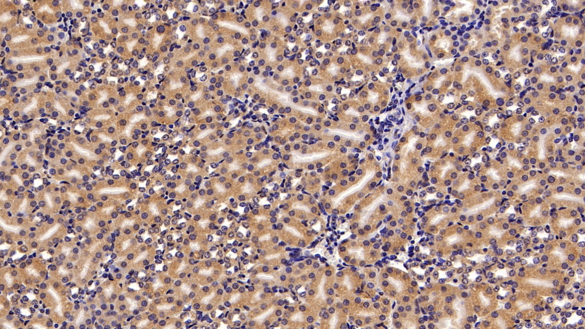 Polyclonal Antibody to Transient Receptor Potential Cation Channel Subfamily M, Member 4 (TRPM4)