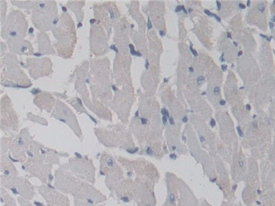 Polyclonal Antibody to Transient Receptor Potential Cation Channel Subfamily M, Member 7 (TRPM7)