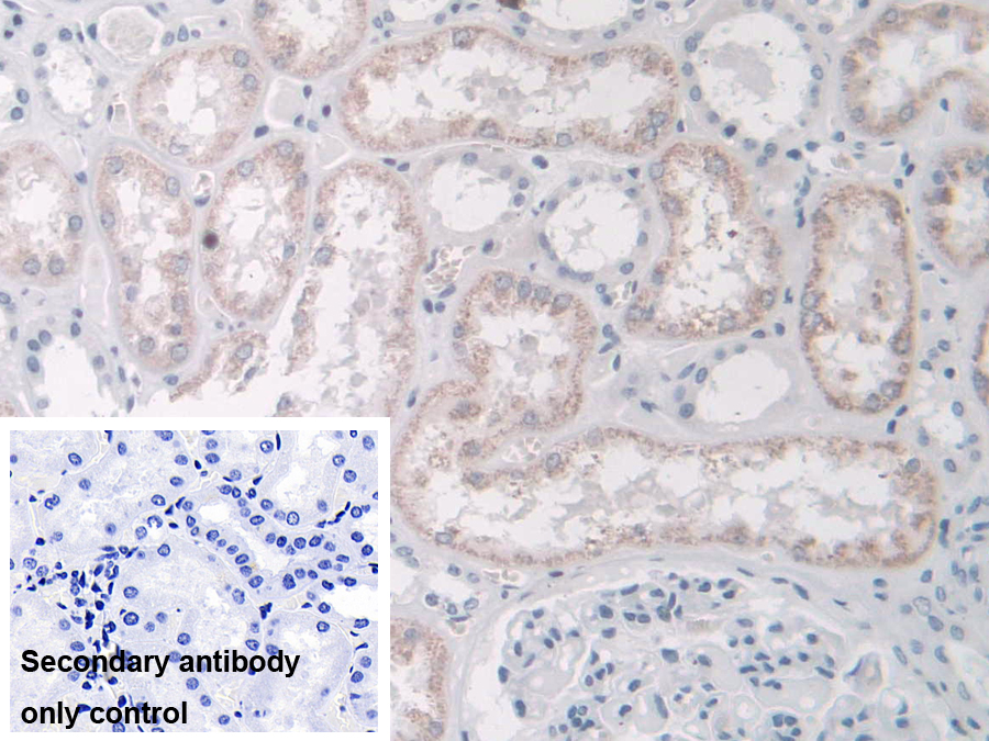 Polyclonal Antibody to Transient Receptor Potential Cation Channel Subfamily C, Member 6 (TRPC6)