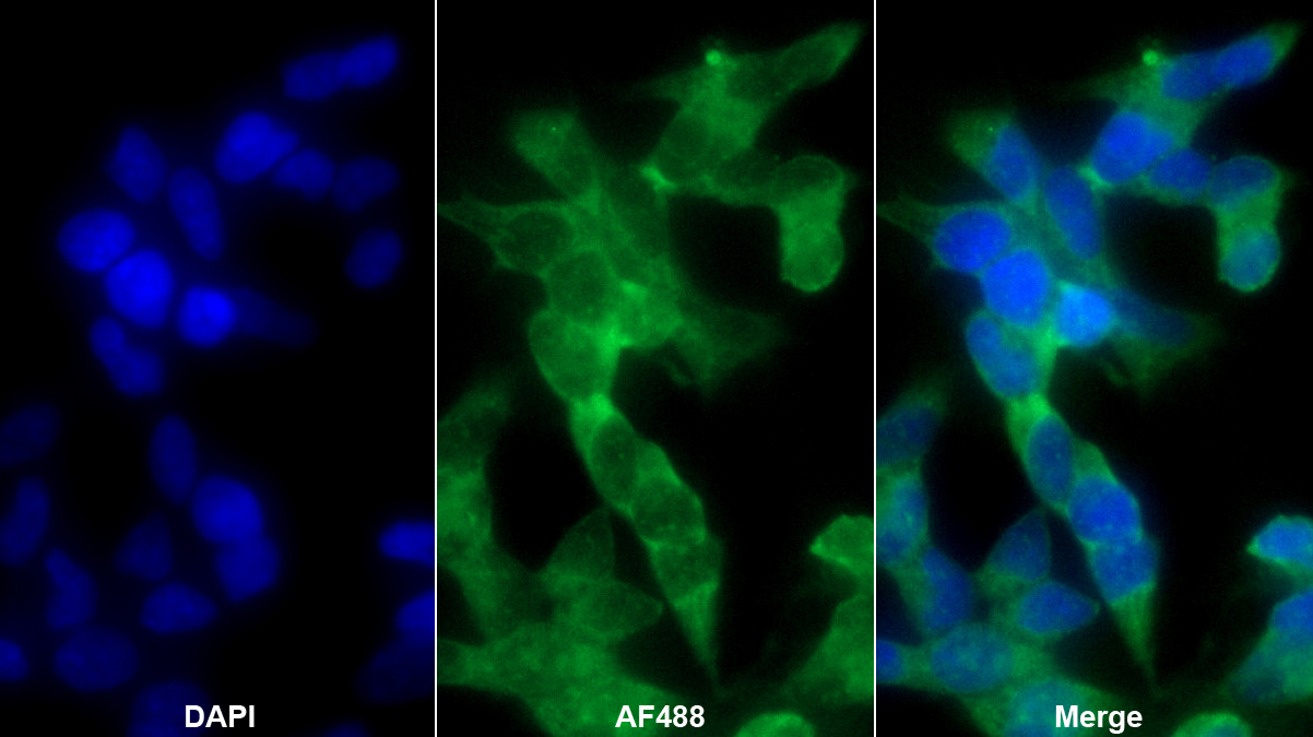 Polyclonal Antibody to Septin 6 (SEPT6)