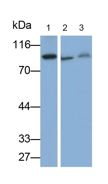 Polyclonal Antibody to Ribonucleotide Reductase M1 (RRM1)