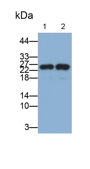 Polyclonal Antibody to Stathmin 2 (STMN2)