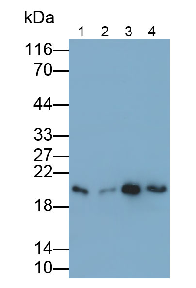 Polyclonal Antibody to Dual Specificity Phosphatase 3 (DUSP3)
