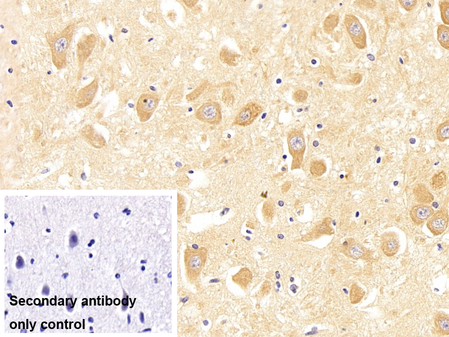 Polyclonal Antibody to G Protein Coupled Estrogen Receptor 1 (GPER)