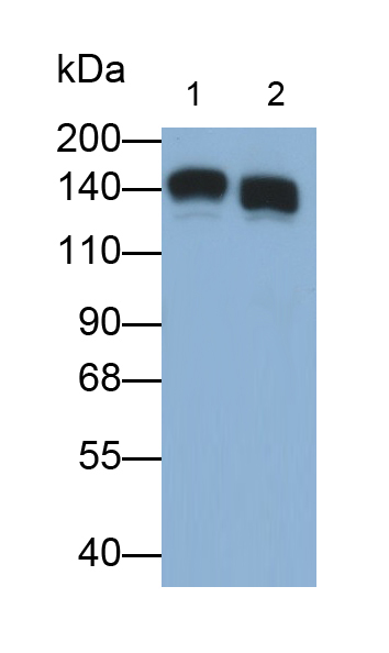 Polyclonal Antibody to Microtubule Associated Protein 1S (MAP1S)