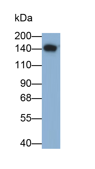 Polyclonal Antibody to Microtubule Associated Protein 1S (MAP1S)