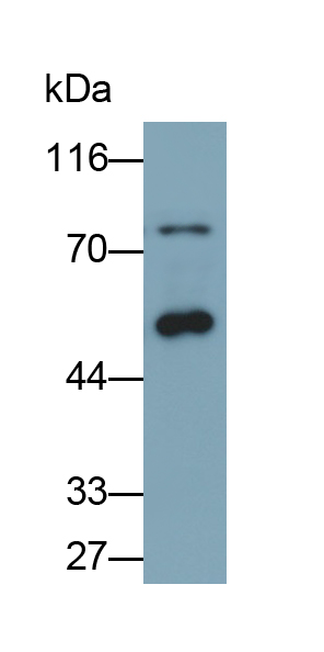 Polyclonal Antibody to Aspartyl tRNA Synthetase 2, Mitochondrial (DARS2)