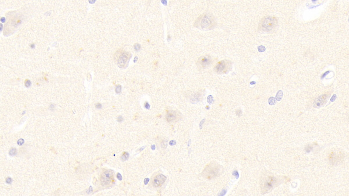 Polyclonal Antibody to Heat Shock 40kDa Protein 2 (HSPF2)