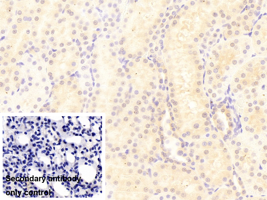 Polyclonal Antibody to Heat Shock 40kDa Protein 3 (HSPF3)