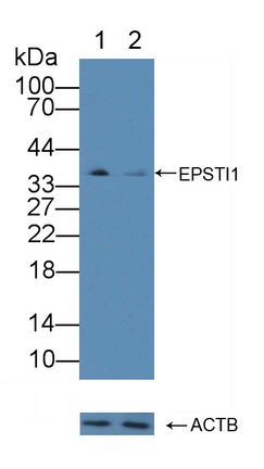 Polyclonal Antibody to Epithelial Stromal Interaction 1, Breast (EPSTI1)