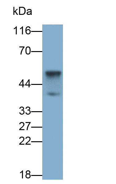 Polyclonal Antibody to Forkhead Box Protein L2 (FOXL2)