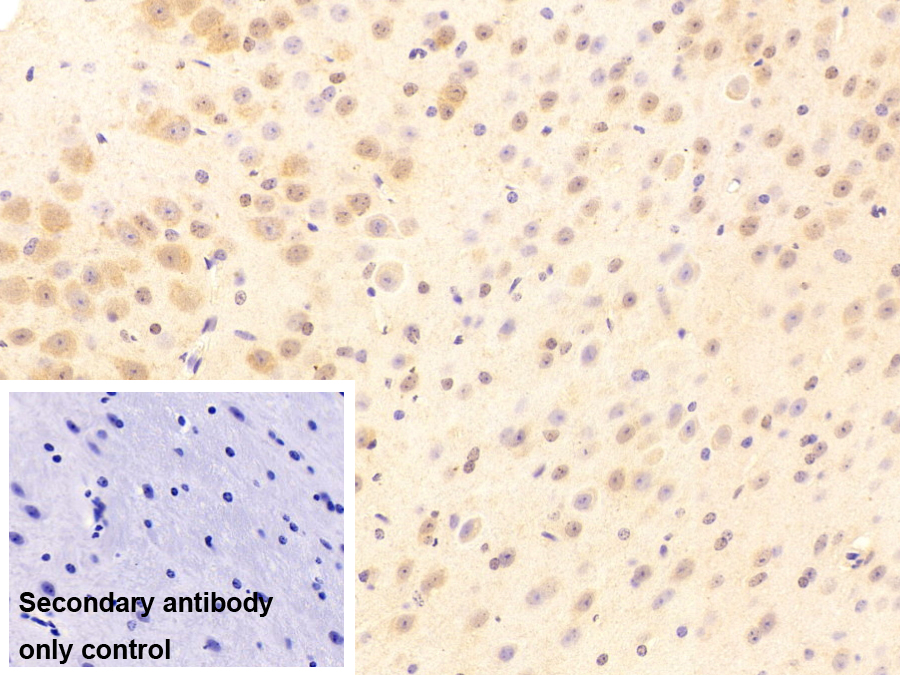 Polyclonal Antibody to Proteasome Subunit Alpha Type 4 (PSMa4)