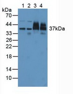 Polyclonal Antibody to Proteasome 26S Subunit, Non ATPase 7 (PSMD7)