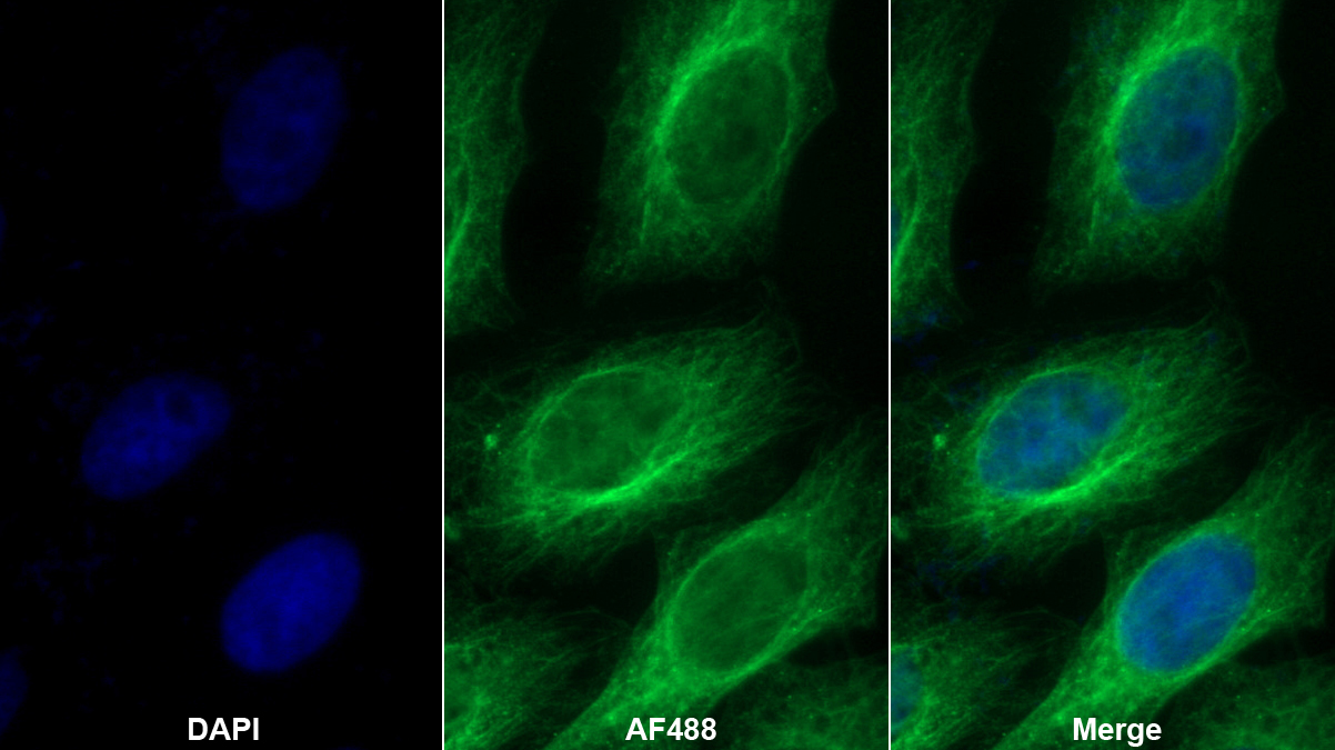 Polyclonal Antibody to Pregnancy Zone Protein (PZP)