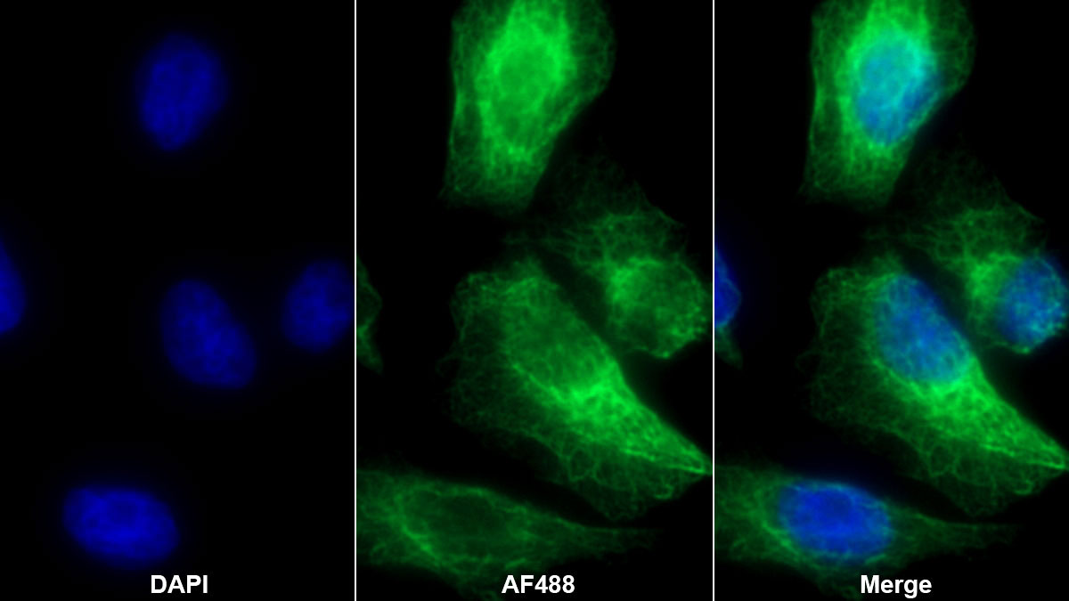 Polyclonal Antibody to B-Raf Proto Oncogene Serine/Threonine Protein Kinase (BRAF)