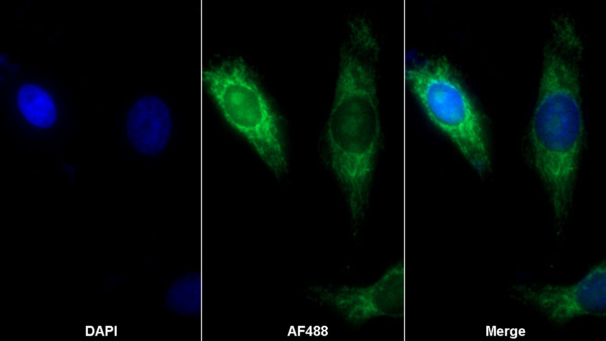 Polyclonal Antibody to Acyl Coenzyme A Dehydrogenase, Short/Very Long Chain (ACADVL)