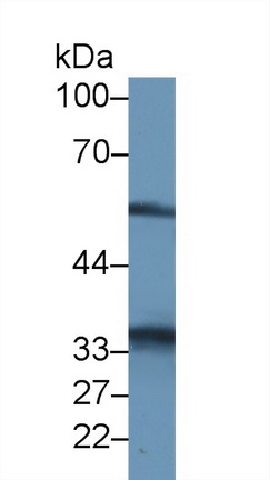 Polyclonal Antibody to ATPase, H+ Transporting, Mitochondrial F1 Complex Beta Polypeptide (ATP5b)
