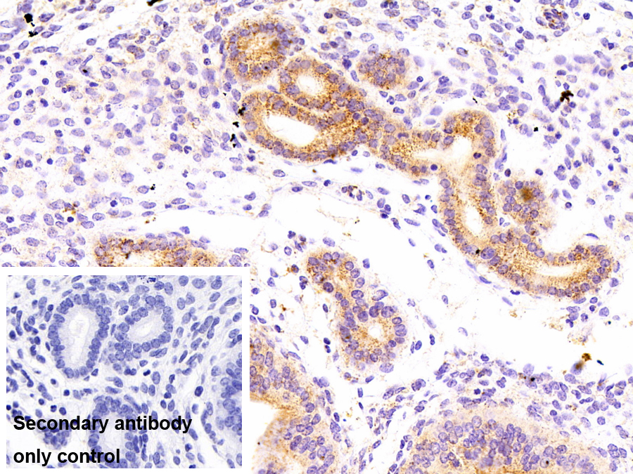 Polyclonal Antibody to ATPase, H+ Transporting, Mitochondrial F1 Complex Alpha Polypeptide (ATP5a)