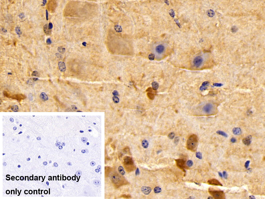 Polyclonal Antibody to Parvalbumin (PVALB)