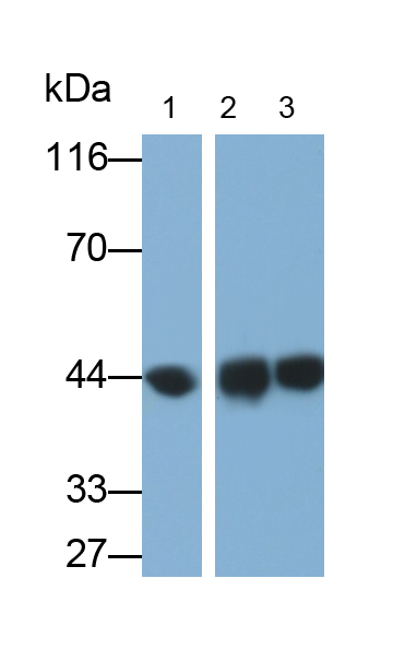 Polyclonal Antibody to Betaine Homocysteine Methyltransferase 2 (BHMT2)