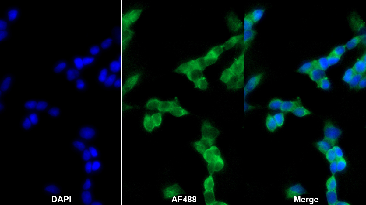 Polyclonal Antibody to Dopa Decarboxylase (DDC)