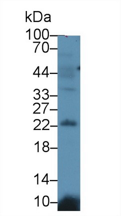 Polyclonal Antibody to Lipocalin 12 (LCN12)