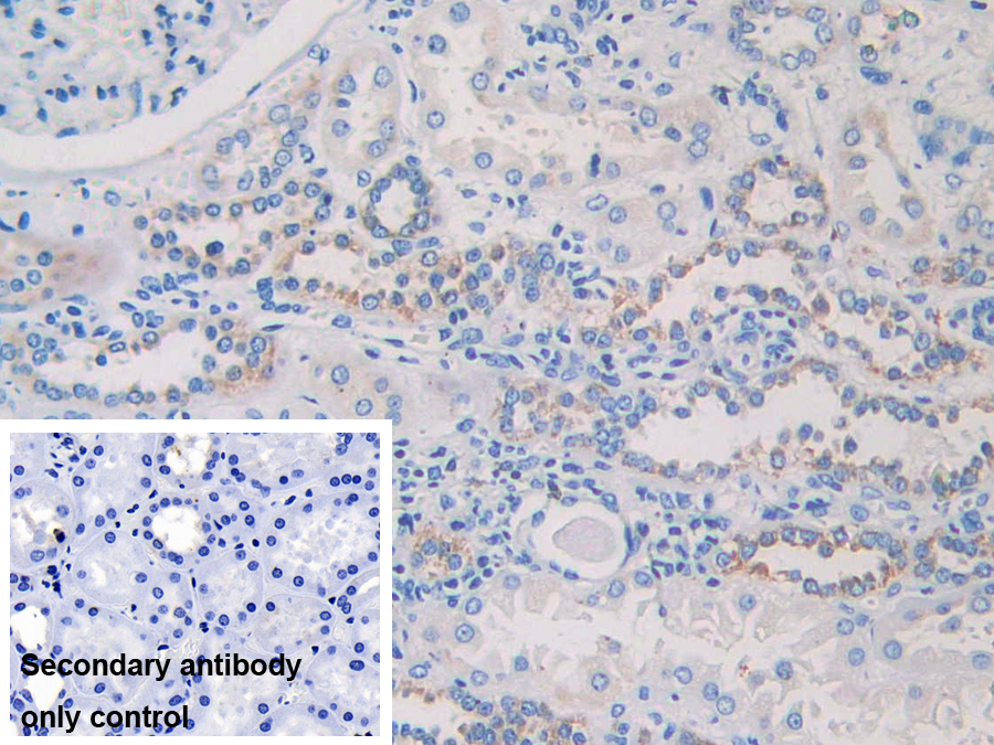 Polyclonal Antibody to Microtubule Associated Protein RP/EB Family, Member 1 (MAPRE1)