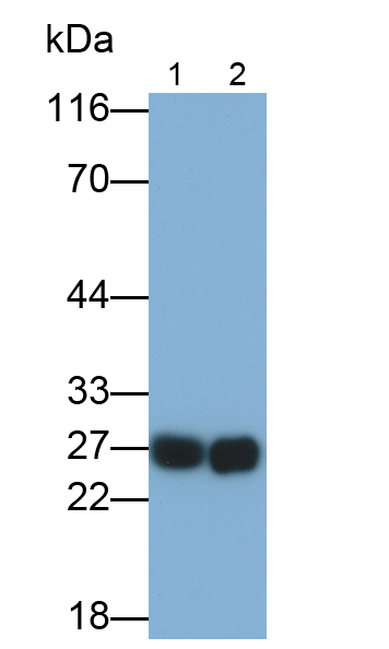 Polyclonal Antibody to Steroidogenic Acute Regulatory Protein (STAR)