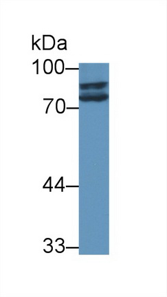 Polyclonal Antibody to Steroid Sulfatase Isozyme S (STS)