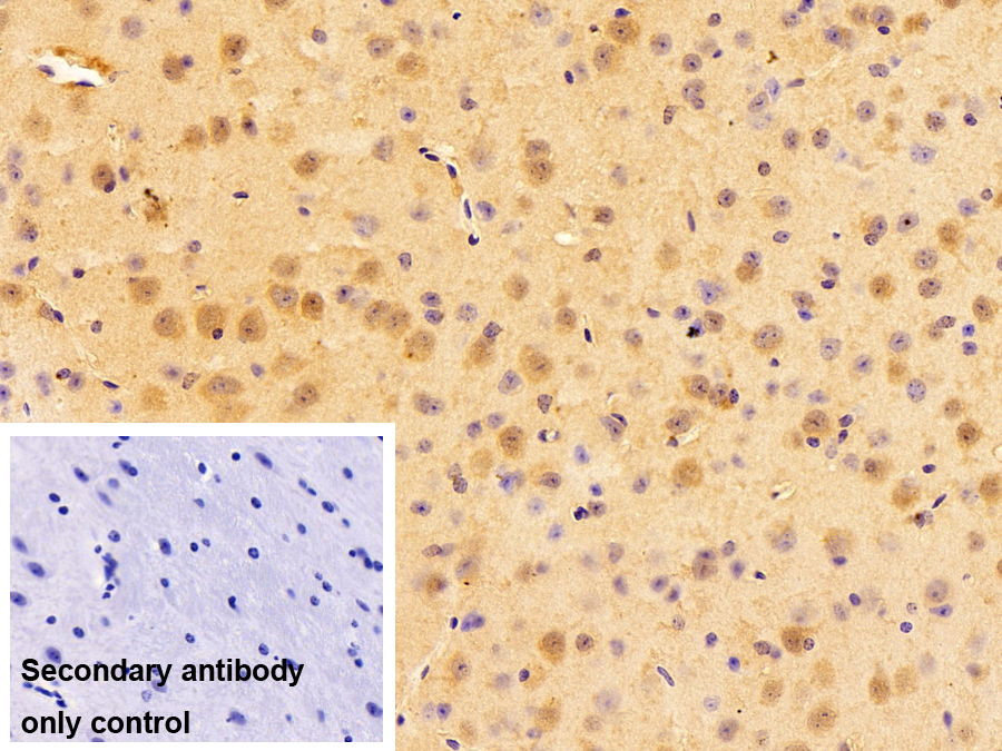 Polyclonal Antibody to Cereblon (CRBN)