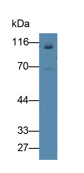 Polyclonal Antibody to Myopalladin (MYPN)
