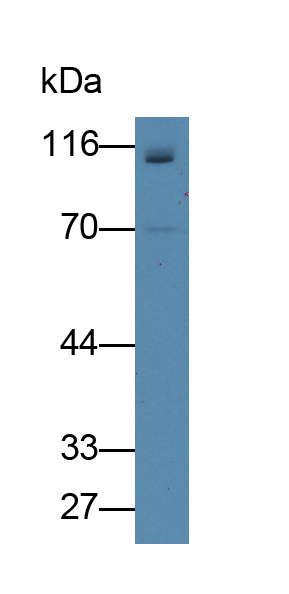 Polyclonal Antibody to Myopalladin (MYPN)