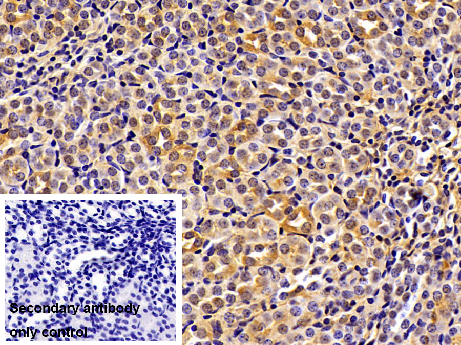 Polyclonal Antibody to Tropomodulin 3 (TMOD3)