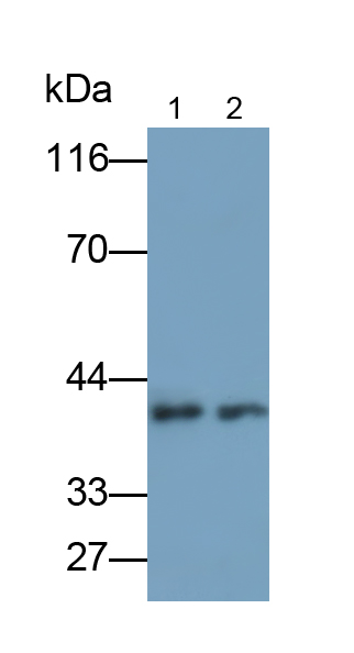 Polyclonal Antibody to Tropomodulin 1 (TMOD1)